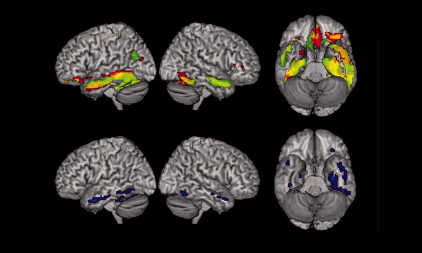 Badanie czynnościowe mózgu
