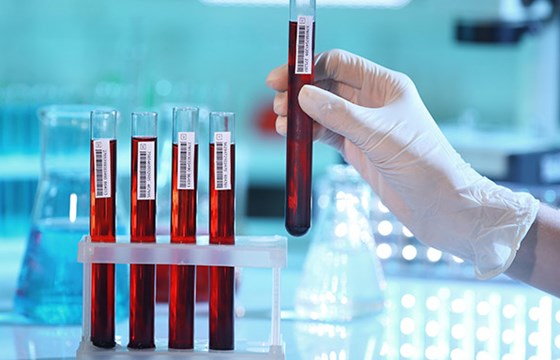 Badania krwi przed zabiegiem