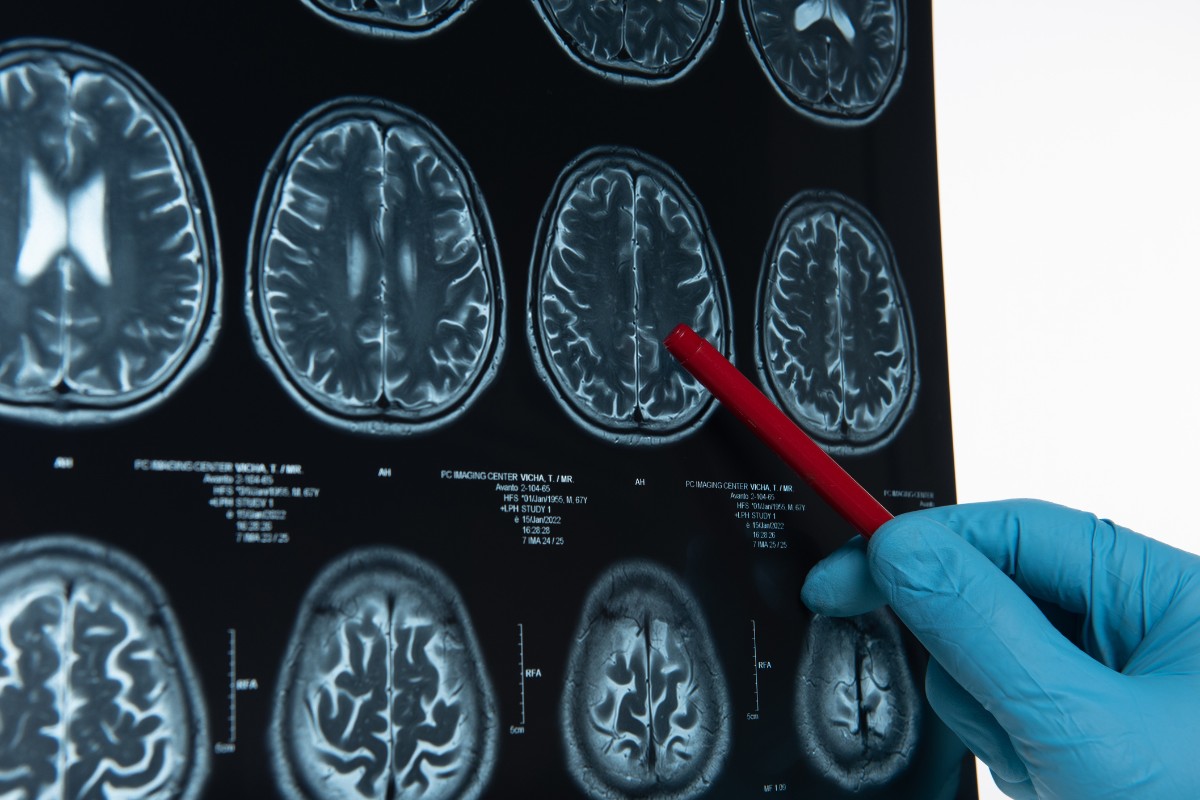 historia i rozwój psychiatrii do czasów współczesnych